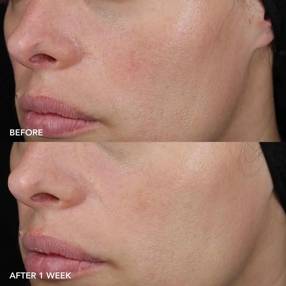 IMAGE MD barrier repair recovery balm - Pilt 4