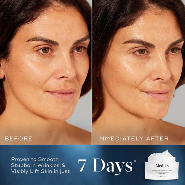 Advanced Night Restore - Pilt 4