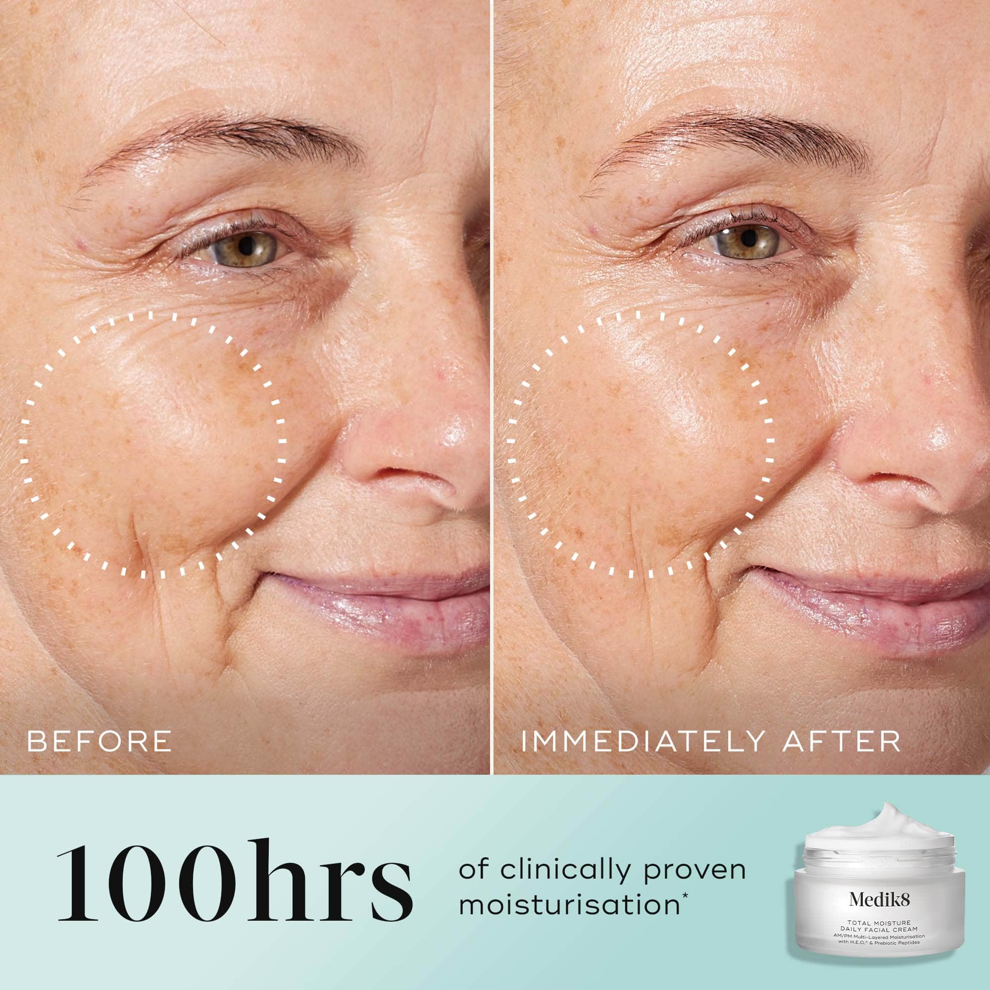 Total Moisture Daily Facial Cream - Pilt 3