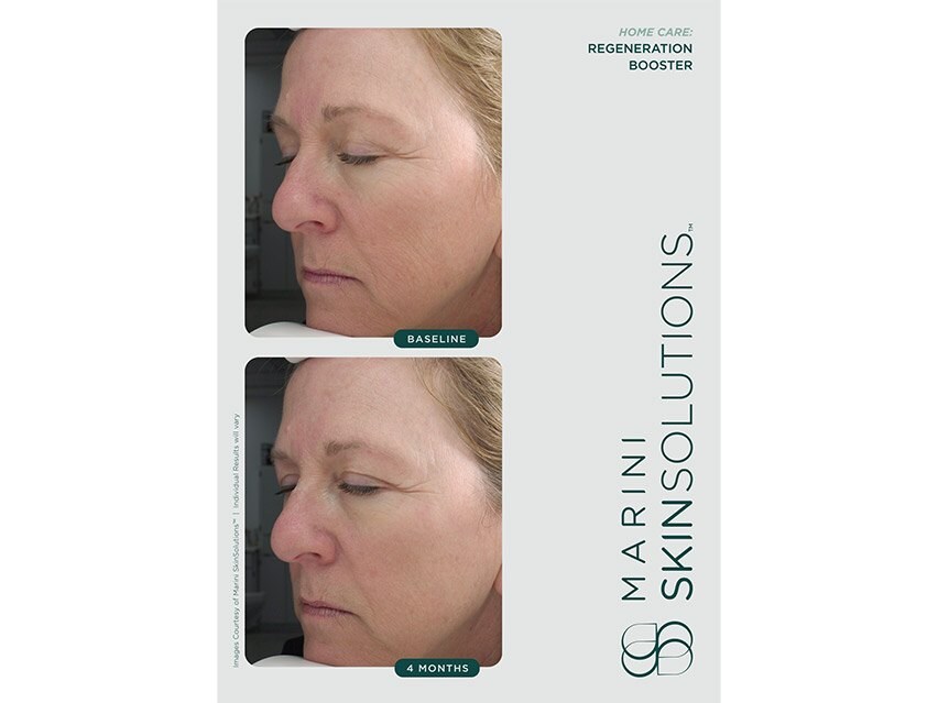 Regeneration Booster - Pilt 2